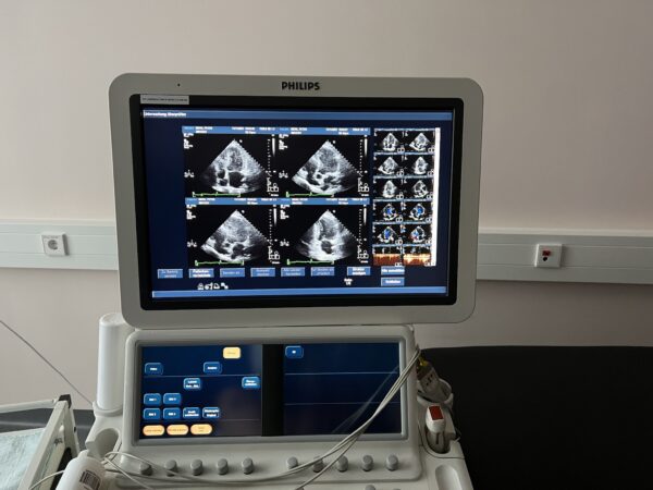 Ultraschall Herz-Diagnosegerät Modell 1